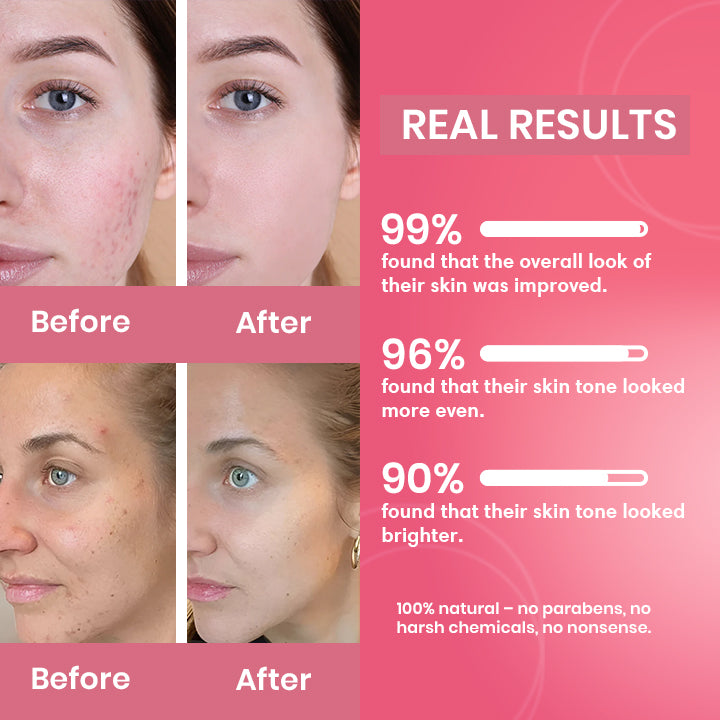 Turmeric & Kojic Acid Pads – Skin Brightening & Acne Treatment